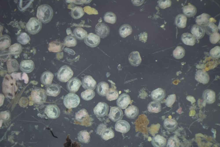 Gold clam larvae under microscope