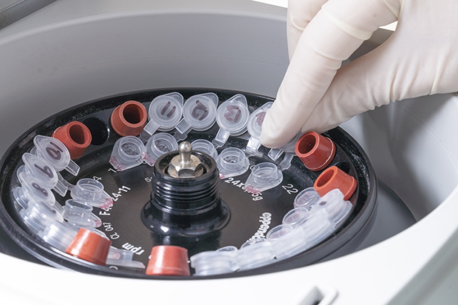 Loading samples into a microcentrifuge,