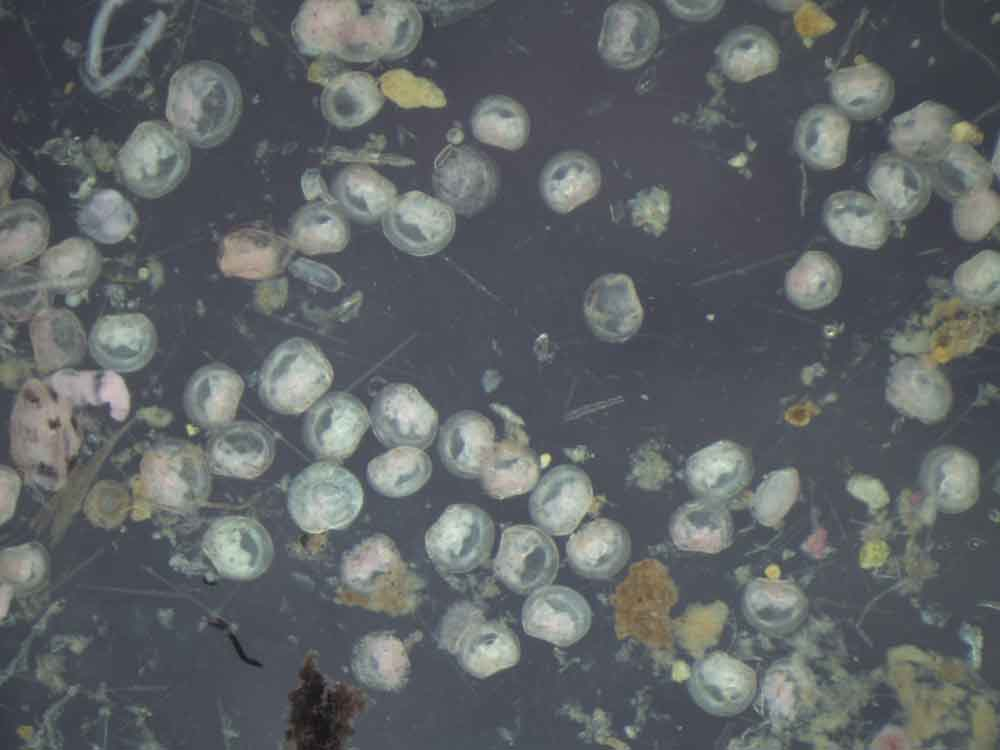 Gold clam larvae under microscope
