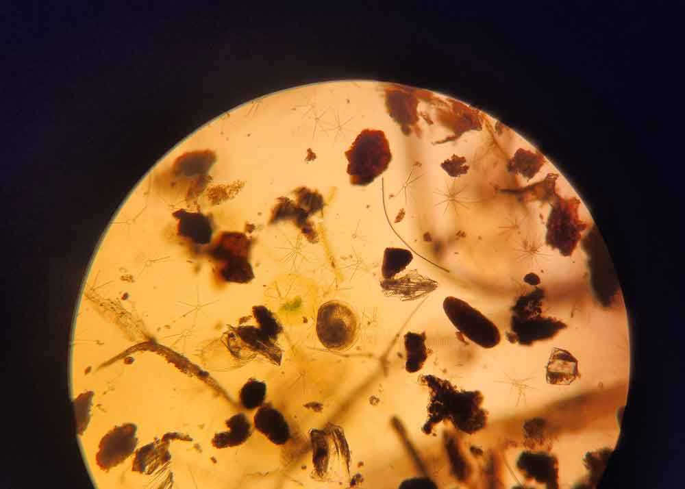  A single D shaped clam larvae in natural sample with detritus and phytoplankton viewed under 100x magnification. What we observe when looking for them in water column samples. 